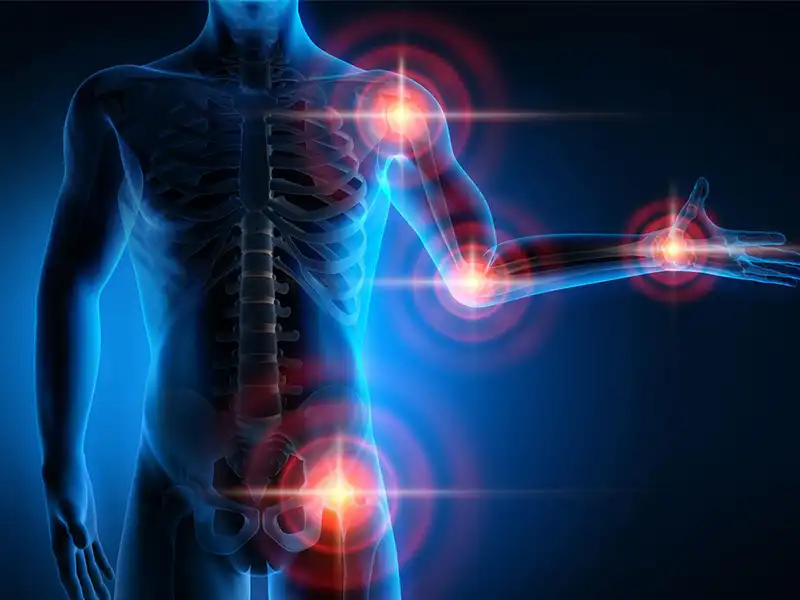 آرتروز چیست و چه علائمی دارد؟